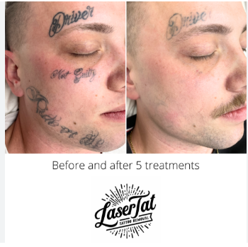 From Cover-Up to Clean Slate