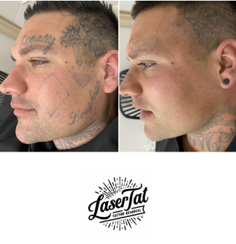 From Cover-Up to Clean Slate
